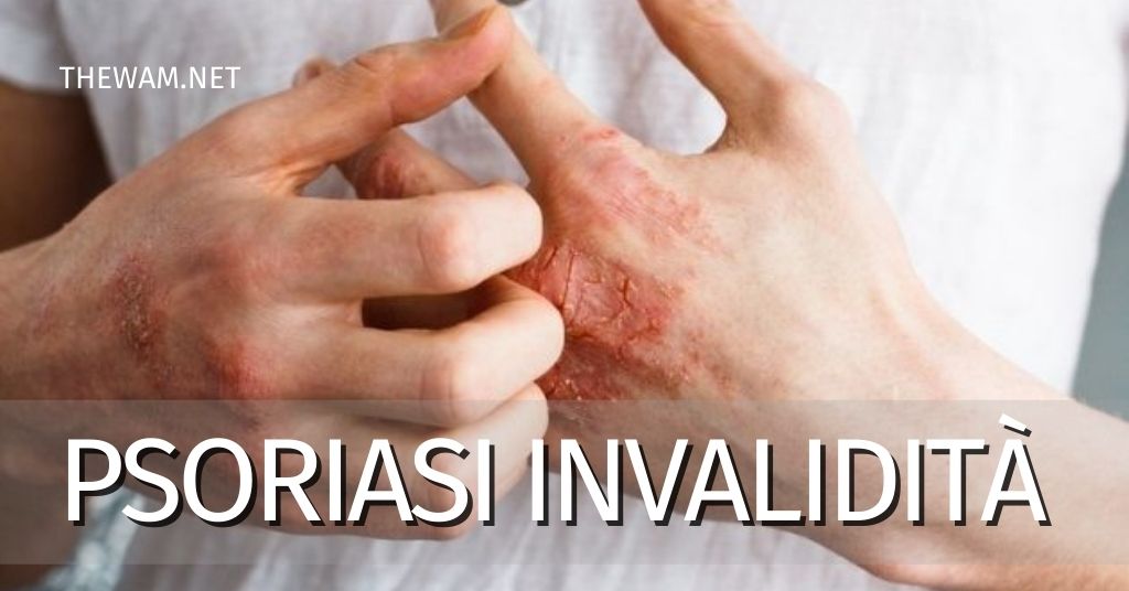 Psoriasi Invalidità 2021: requisiti e come richiederla